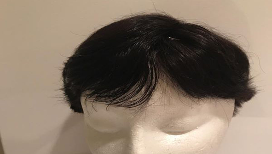 Top Pieces – Solution For ALOPECIA ARETA